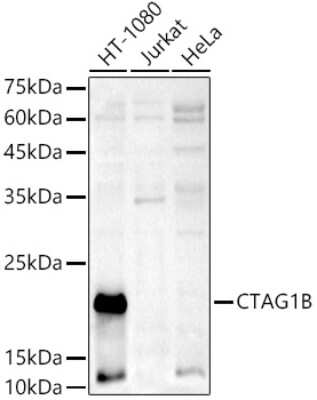 Western Blot: CTAG1B Antibody [NBP2-92840] - Analysis of extracts of various cell lines, using CTAG1B antibody (NBP2-92840) at 1:1000 dilution. Secondary antibody: HRP Goat Anti-Rabbit IgG (H+L) at 1:10000 dilution. Lysates/proteins: 25ug per lane. Blocking buffer: 3% nonfat dry milk in TBST. Detection: ECL Basic Kit. Exposure time: 180s.